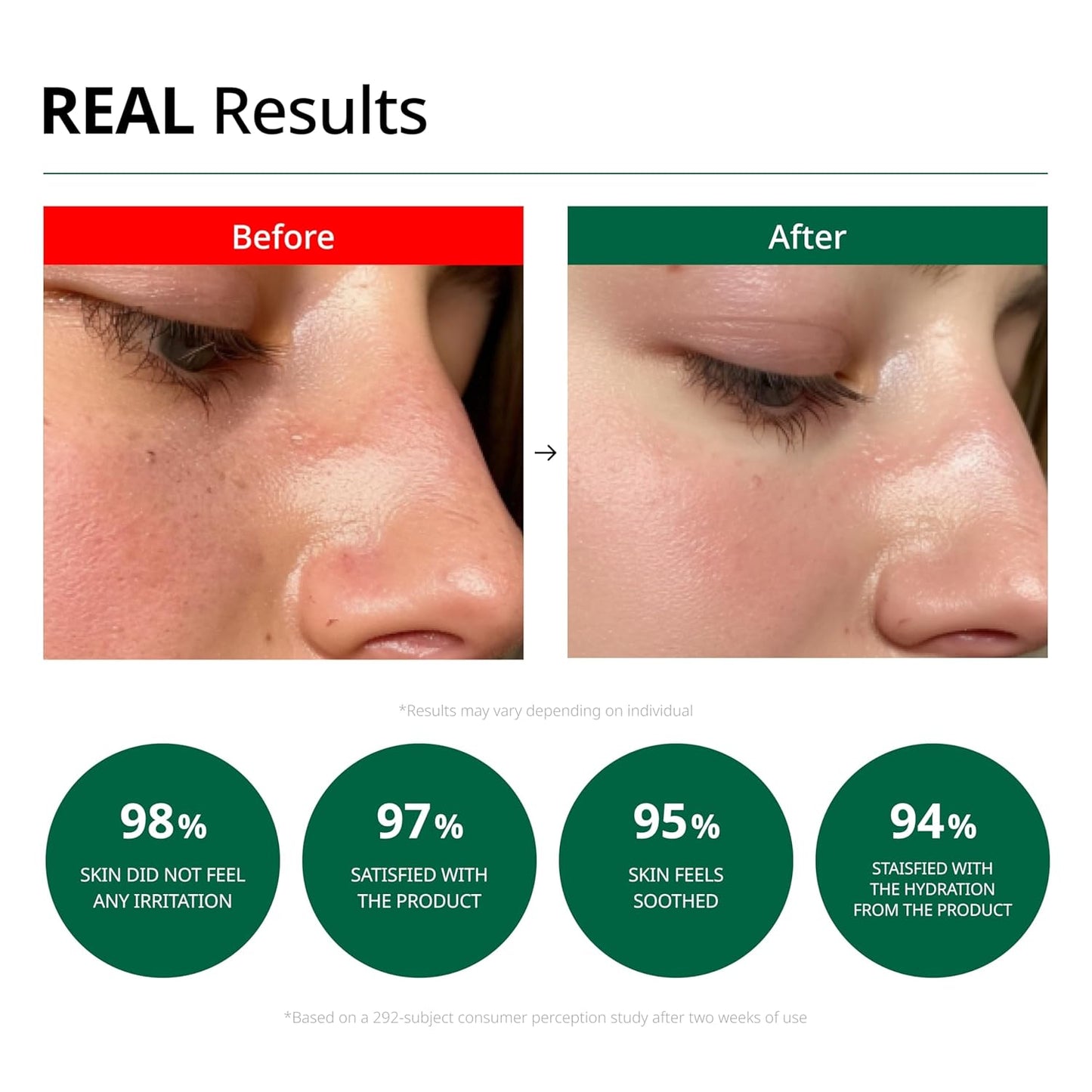 Dr.G Blemish Cream