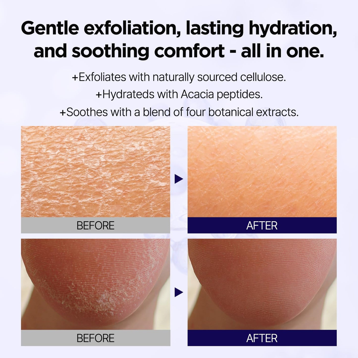 Deep Clean Soft Peeling Gel