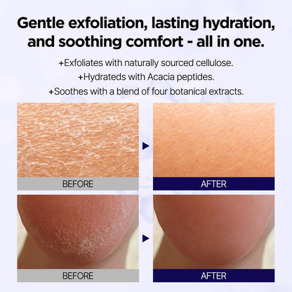 Deep Clean Soft Peeling Gel