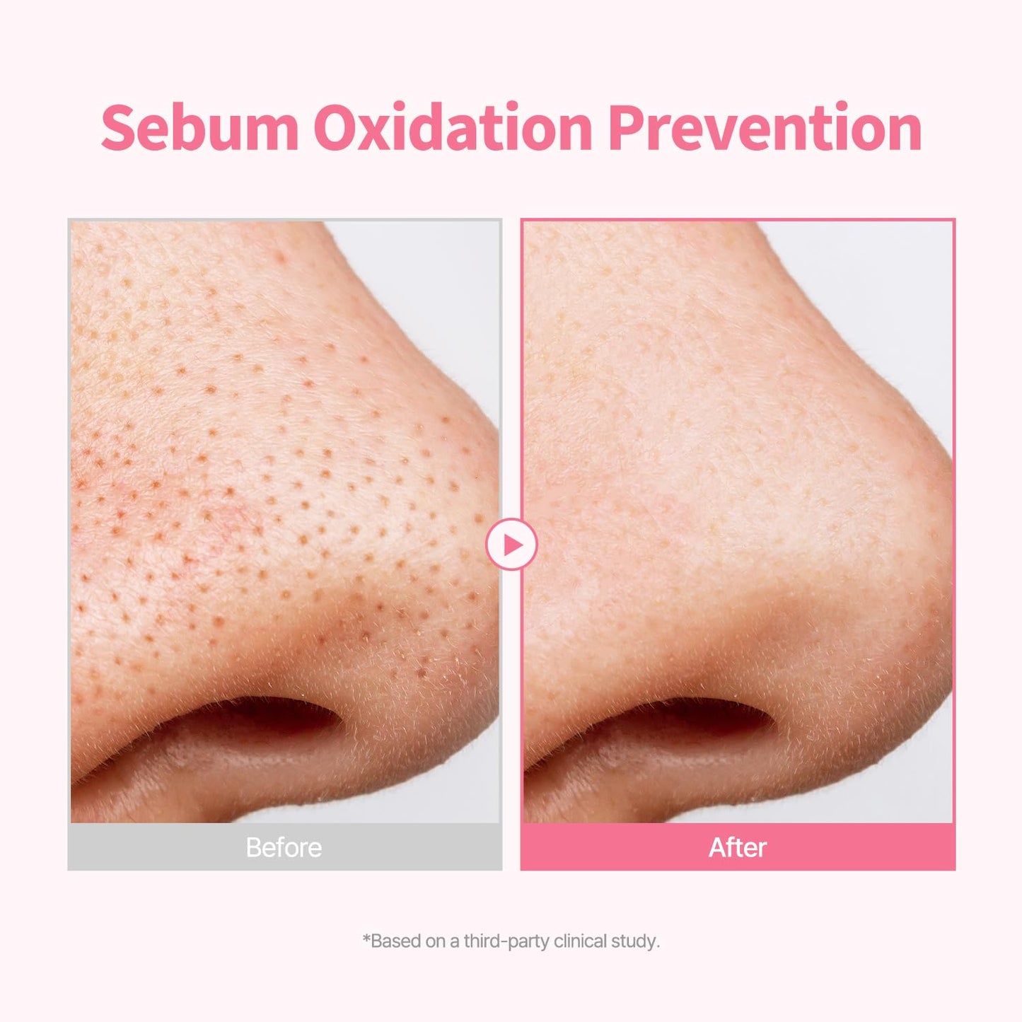 Pore Tightening Serum