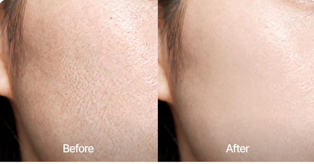 Anti-aging Enriching Firming Cream